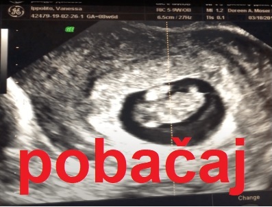 abortus
